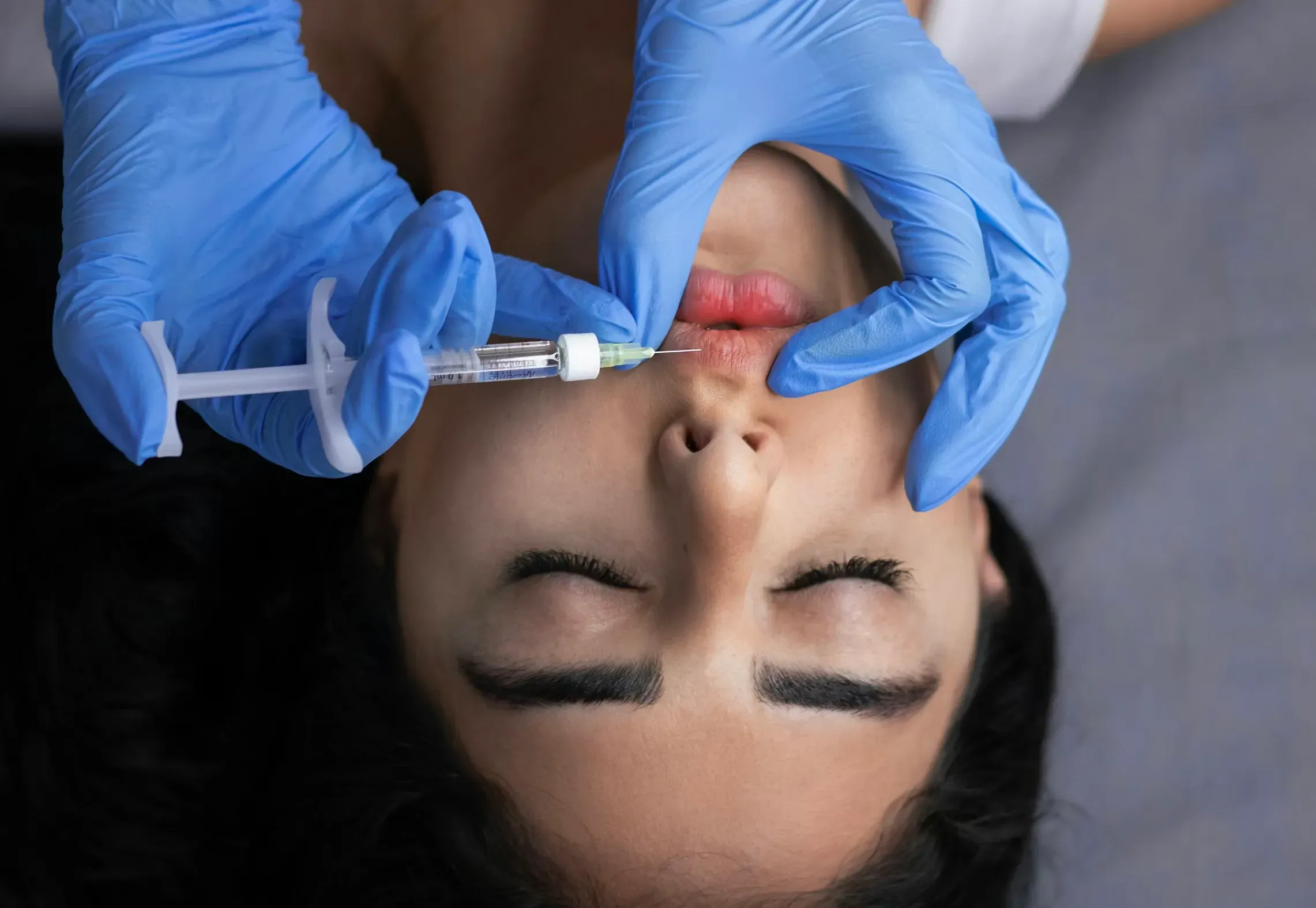 Preenchimento labial